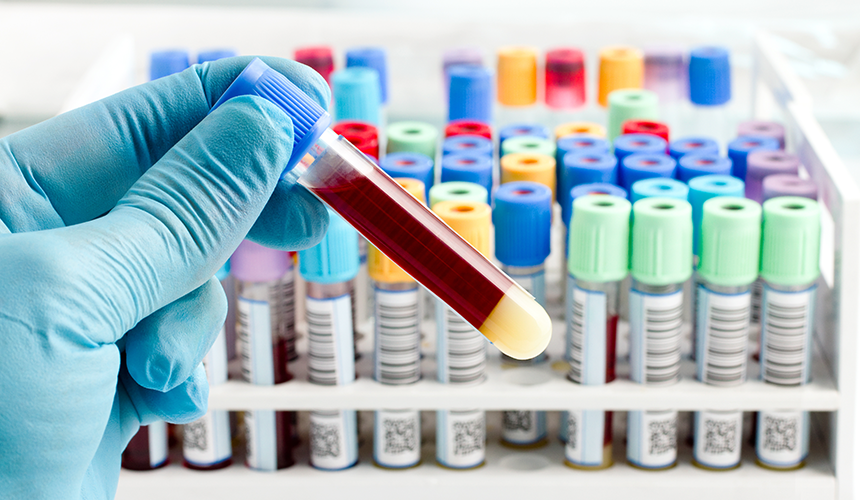 優(yōu)異品質(zhì)  準(zhǔn)確檢測(cè)