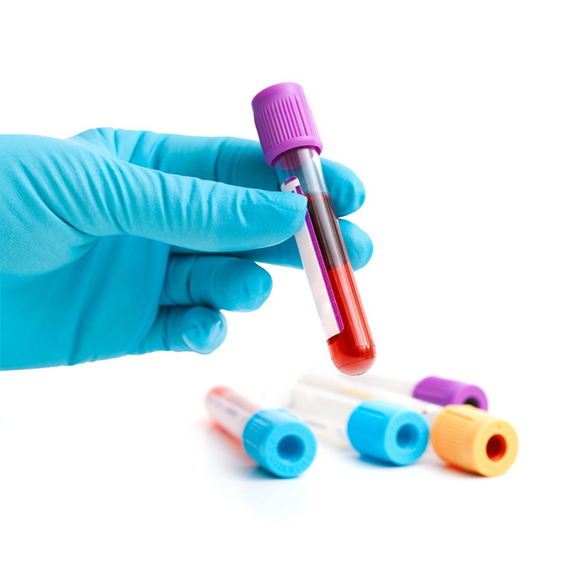 真空采血管