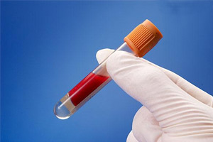 血液知識 一目了然