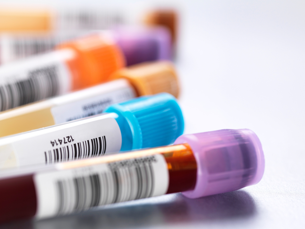 真空采血管的性能驗證