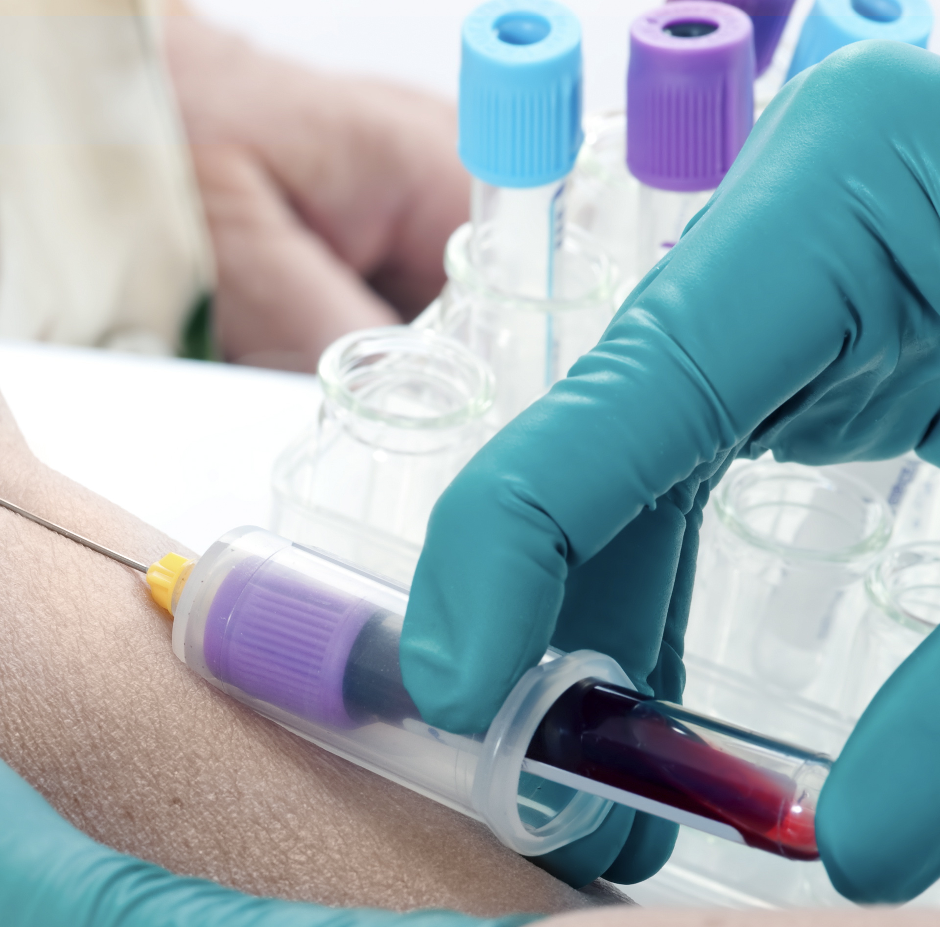 真空采血管采血順序